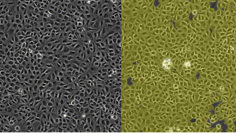AI Confluency Analysis For Enhanced Precision In 2D Cell Culture