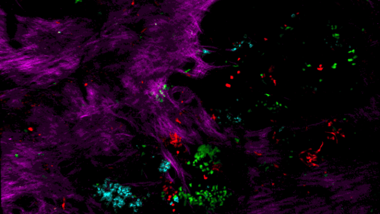 In Vivo Multi Color Imaging of a Confetti Breast Cancer Mouse Model